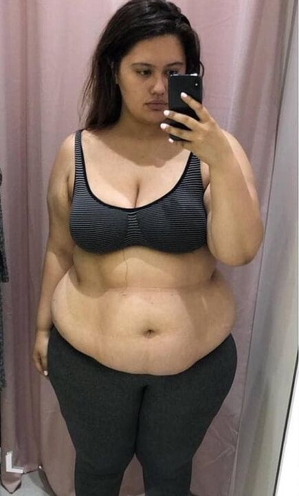 E urreja trupin për shkak të kilogramëve të tepërt.